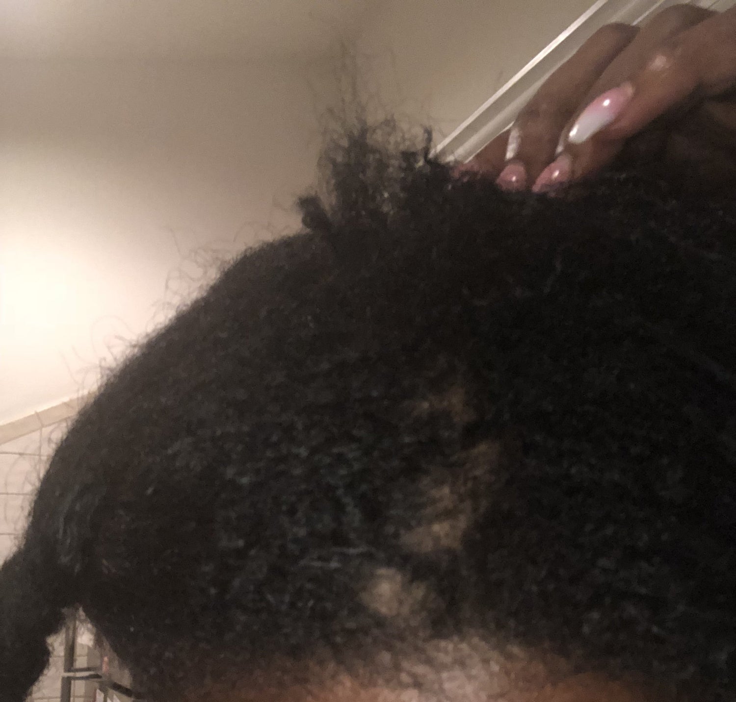 Postpartum Hair Loss | The Love Line LLC